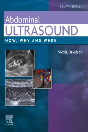 Abdominal Ultrasound E-Book