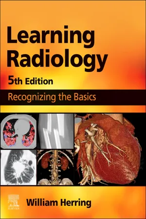 Learning Radiology E-Book