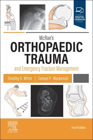McRae's Orthopaedic Trauma and Emergency Fracture Management E-Book
