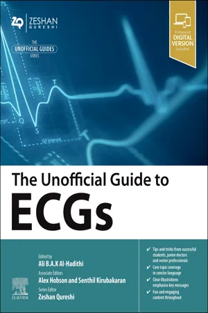The Unofficial Guide to ECGs - E-Book