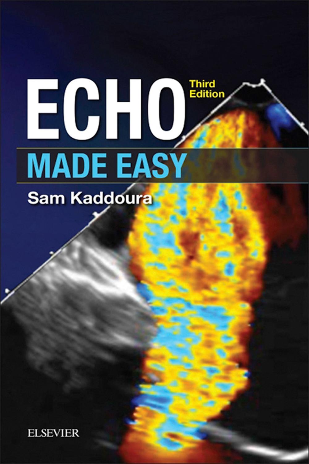 PDF] Echo Made Easy E-Book by Sam Kaddoura, 3rd edition