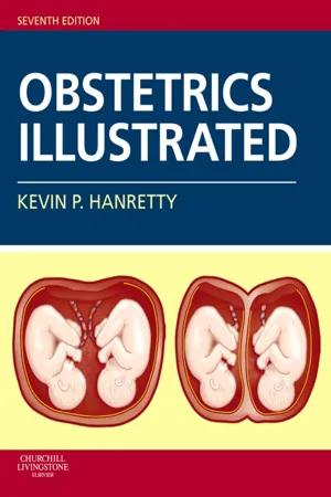 Obstetrics Illustrated E-Book