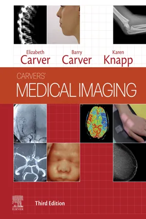 Medical Imaging - E-Book