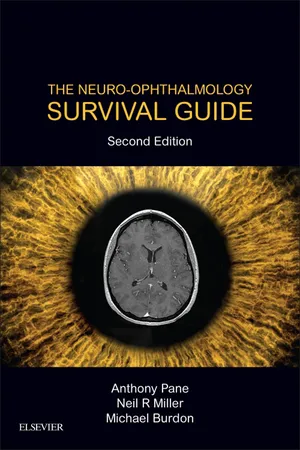 The Neuro-Ophthalmology Survival Guide E-Book