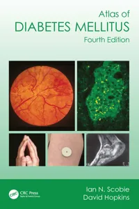 Atlas of Diabetes Mellitus_cover