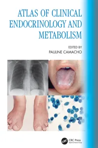 Atlas of Clinical Endocrinology and Metabolism_cover