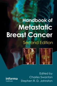 Handbook of Metastatic Breast Cancer_cover