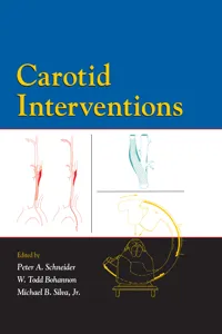 Carotid Interventions_cover