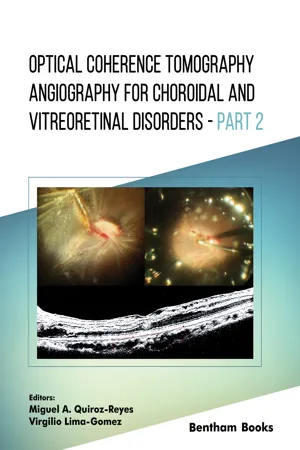 Optical Coherence Tomography Angiography for Choroidal and Vitreoretinal Disorders – Part 2