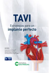 TAVI - Estrategias para un implante perfecto_cover