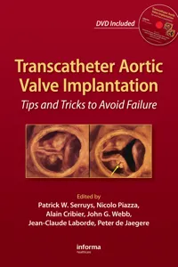 Transcatheter Aortic Valve Implantation_cover