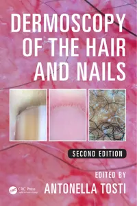 Dermoscopy of the Hair and Nails_cover