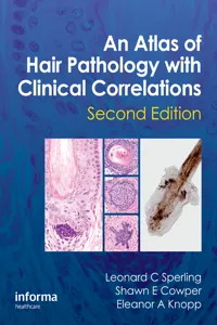An Atlas of Hair Pathology with Clinical Correlations_cover