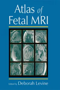 Atlas of Fetal MRI_cover