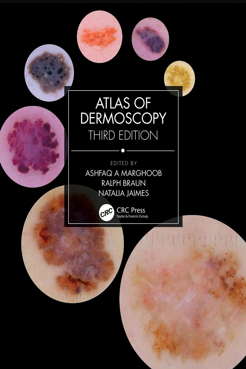PDF] Atlas of Dermoscopy by Ashfaq A Marghoob, 3rd edition