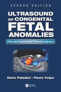 Ultrasound of Congenital Fetal Anomalies_cover