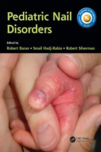 Pediatric Nail Disorders_cover