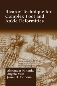 Ilizarov Technique for Complex Foot and Ankle Deformities_cover