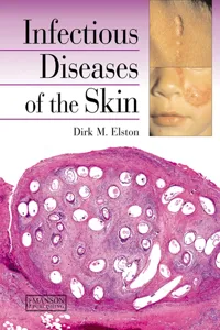 Infectious Diseases of the Skin_cover