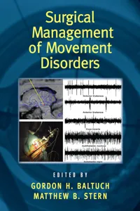 Surgical Management of Movement Disorders_cover