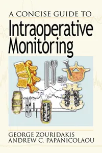 A Concise Guide to Intraoperative Monitoring_cover