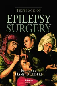 Textbook of Epilepsy Surgery_cover