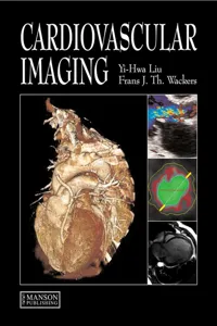 Cardiovascular Imaging_cover