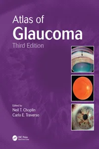 Atlas of Glaucoma_cover