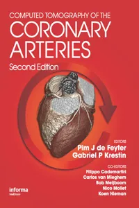 Computed Tomography of the Coronary Arteries_cover