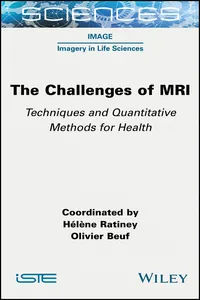 The Challenges of MRI_cover