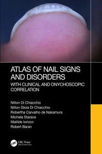 Atlas of Nail Signs and Disorders with Clinical and Onychoscopic Correlation_cover