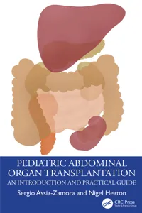 Pediatric Abdominal Organ Transplantation_cover