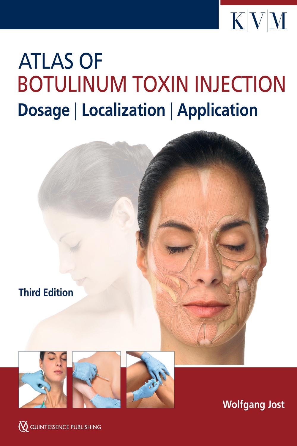 PDF] Atlas of Botulinum Toxin Injection by Jost, 3rd edition