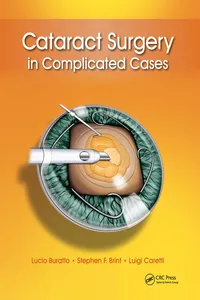 Cataract Surgery in Complicated Cases_cover