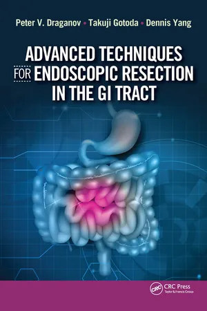 Advanced Techniques for Endoscopic Resection in the GI Tract