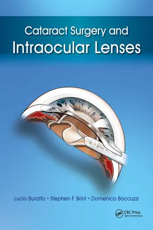 Cataract Surgery and Intraocular Lenses