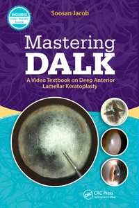 Mastering DALK_cover