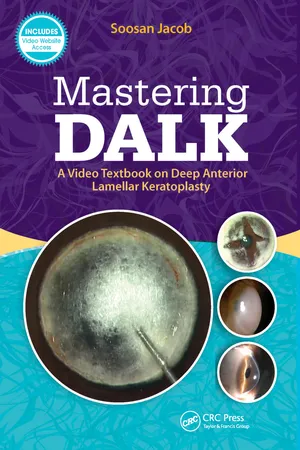 Mastering DALK