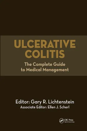 Ulcerative Colitis