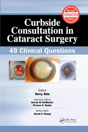 Curbside Consultation in Cataract Surgery