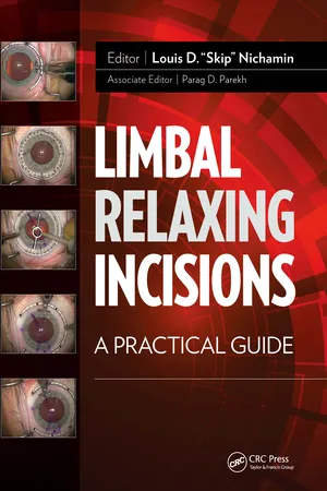 Limbal Relaxing Incisions