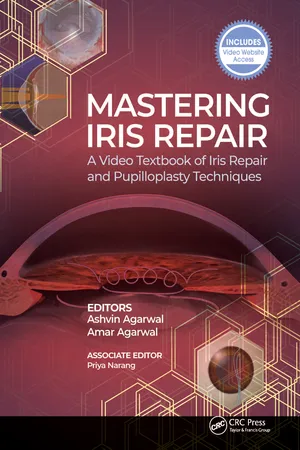 Mastering Iris Repair