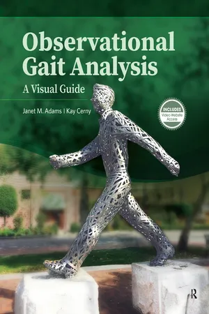 Observational Gait Analysis