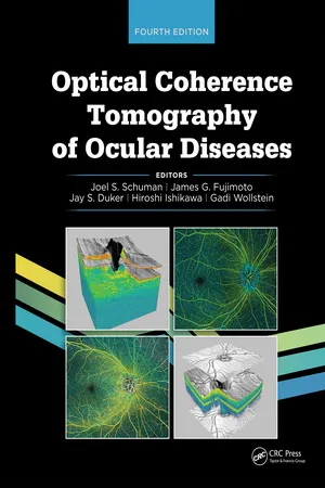 Optical Coherence Tomography of Ocular Diseases