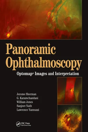 Panoramic Ophthalmoscopy