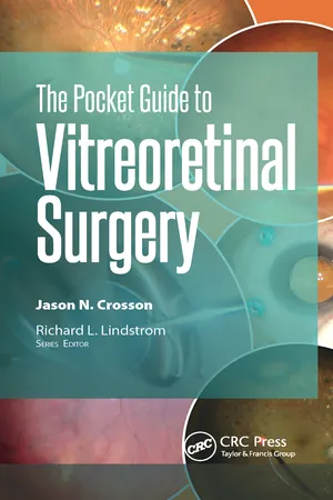 The Pocket Guide to Vitreoretinal Surgery