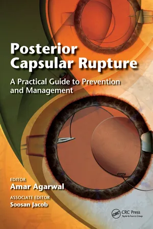 Posterior Capsular Rupture