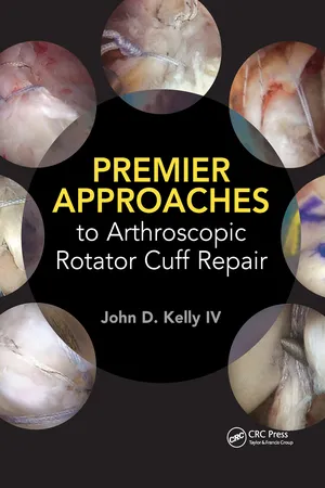 Premier Approaches to Arthroscopic Rotator Cuff Repair