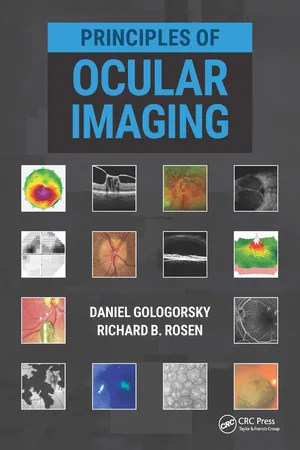 Principles of Ocular Imaging