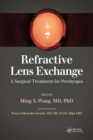 Refractive Lens Exchange